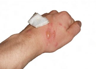 Niebezpieczna roślina w Katowicach. Barszcz Sosnowskiego znaleziony w 6 miejscach