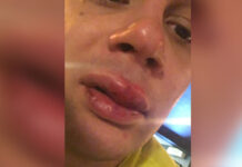 Pobicie na ulicy Sokolskiej w Katowicach. „Mam rozwalone usta, spuchnięte oraz poruszają mi się zęby”