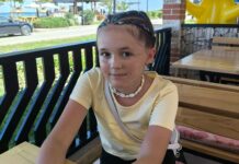 Mała Alicja przeszła pionierską operację w Katowicach. Pierwszy taki zabieg na twarzy dziecka w Polsce