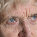 Jak przygotować się do operacji zaćmy? Przewodnik dla pacjentów 60+
